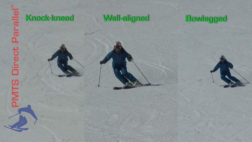 Alignment ~ On-snow Assessment eVideo